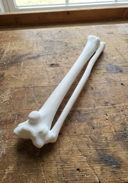 Radius & Ulna – 100% Anatomically Accurate – Asklepios Series - Model preview 2