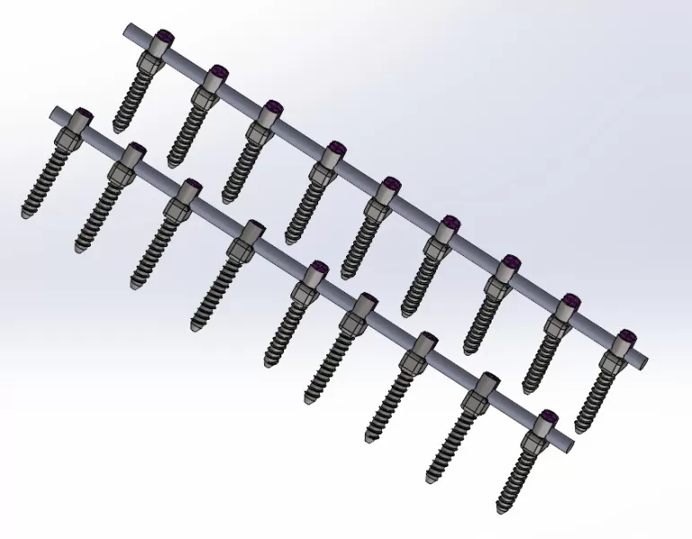 pedicle fixation system - Model preview 1